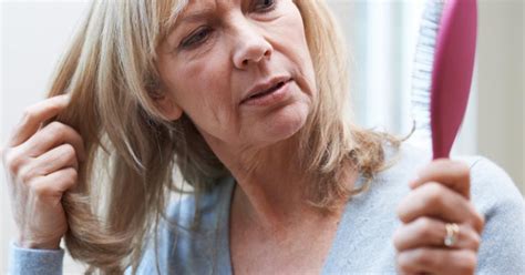 Image result for Diffuse Alopecia