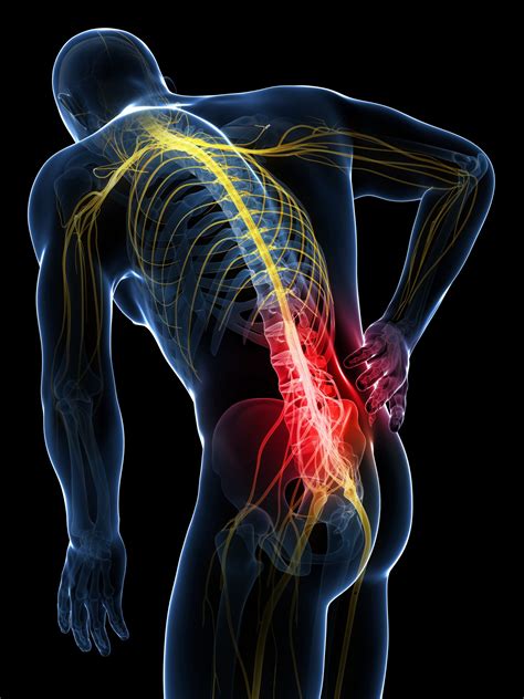 Sciatic nerve pain: Sciatic nerve injury, compression, irritation