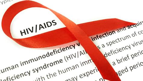 HIV not as infectious soon after transmission as thought | Diseases ...