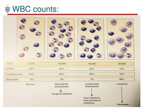 PPT - Haematology for Dental Students - WBC Disorders PowerPoint Presentation - ID:8201941