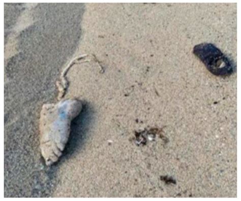 The Role of Forensic Anthropology in the Medico-Legal Investigation of ...