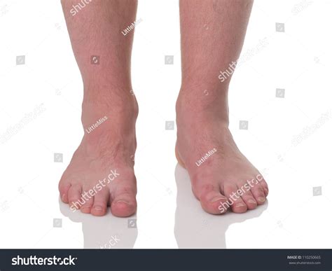 Image result for Front View of Toe