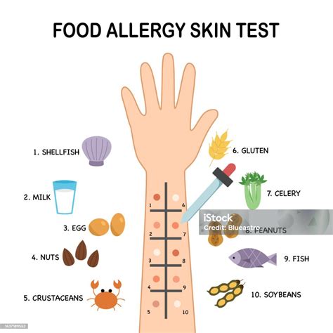 Ilustración de Prueba Cutánea De Alergia Alimentaria En Diseño Plano ...
