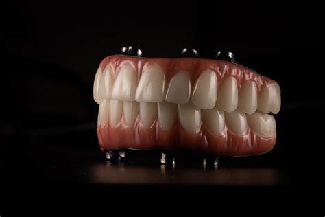 Traditional Dentures vs Implant Supported Dentures | Raio Dental