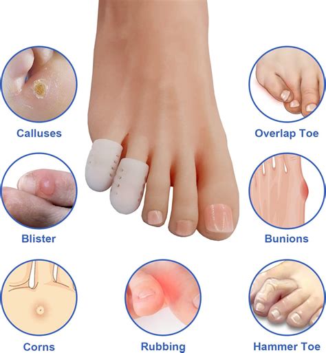 Winiyou Toe Protectors for Men and Women, 14 Packs Silicone India | Ubuy