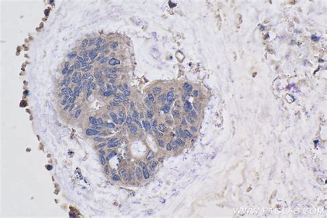 IHCeasy ACYP2 Ready-To-Use IHC Kit KHC1000 | Proteintech