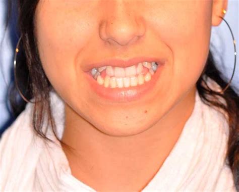 Ortodoncia Borja | Qué podemos hacer por ti