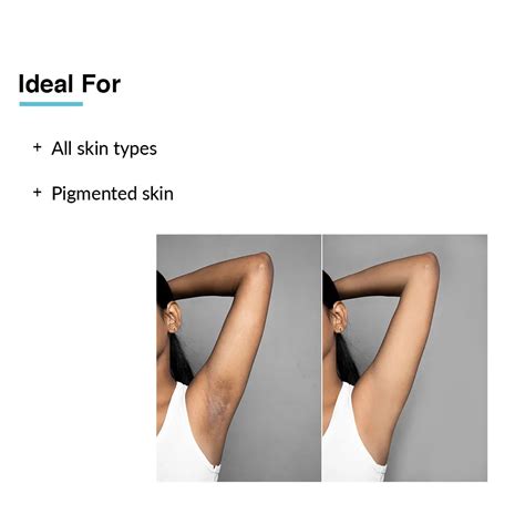 Buy Nigrifix Underarm Lightening Roll-On For Underarms – Fixderma Skincare