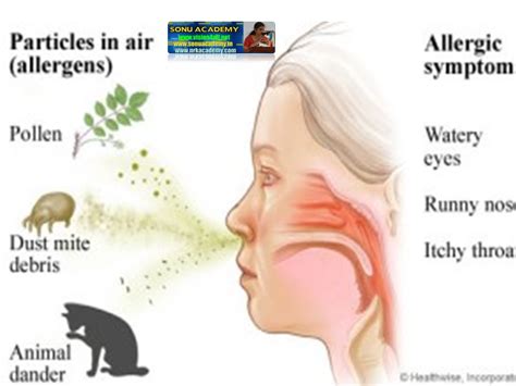 SONU ACADEMY: EXCRETION IN PLANTS -PART 2-TEXT