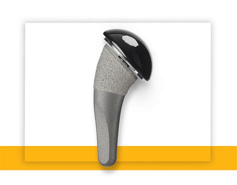 Stryker now offers the only FDA-cleared pyrocarbon bearing material ...