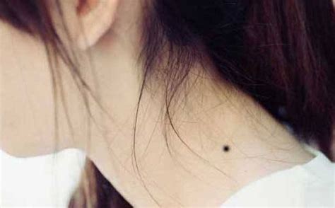 शरीर के Til ka matlab | Mole Meaning in hindi: किसी भी भाग पर मौजूद तिल ...