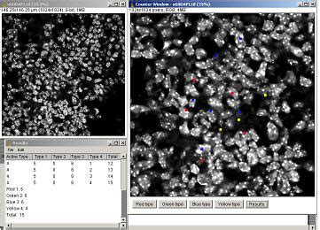 ImageJ Particle Analysis 的图像结果
