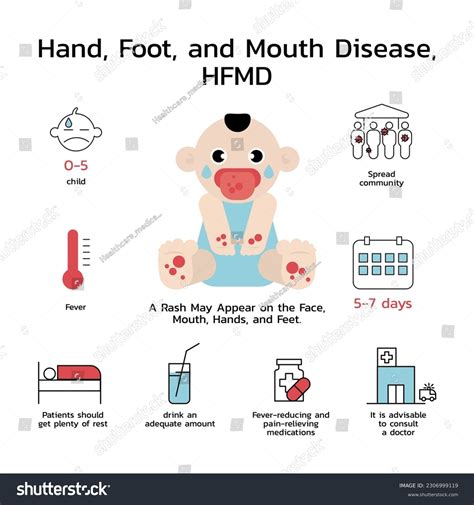 Hand Foot Mouth Disease Hfmd Symptoms Stock Vector (Royalty Free) 2306999119 | Shutterstock
