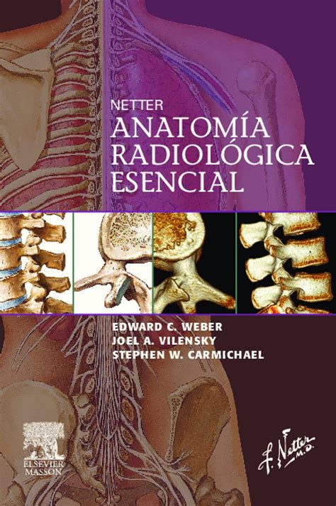 Buy Netter's Anatomia Radiologica Esencial / Netter's Concise ...