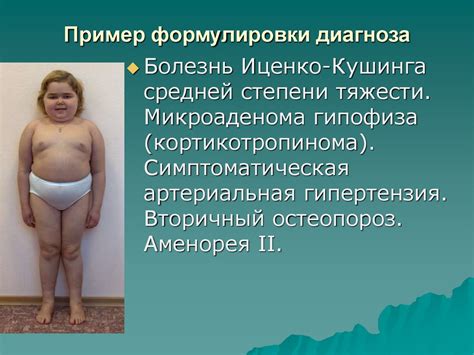 Гиперкортицизм. Классификация. Клиническая картина - online presentation