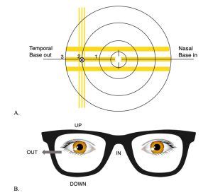 Image result for Lensometry