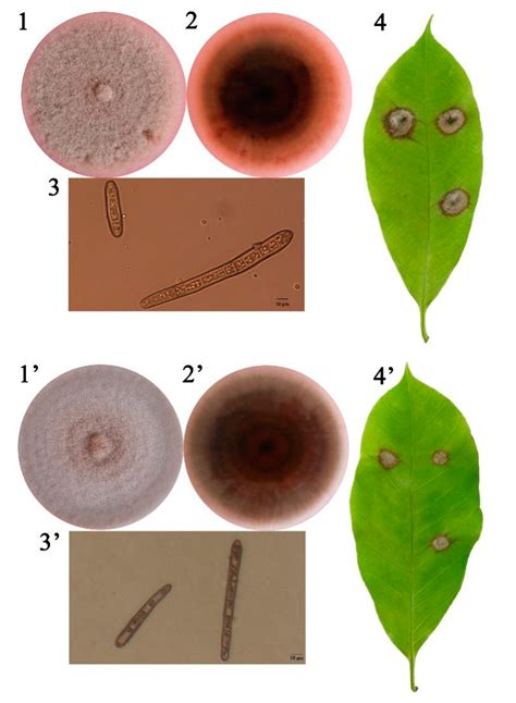 Genomic Characteristics and Comparative Genomics Analysis of Two ...