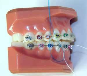 Image result for Using a Floss Threader