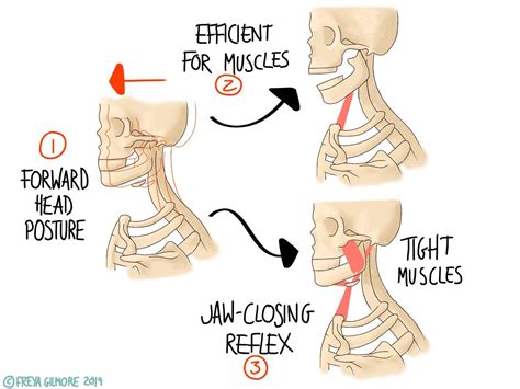 The TMJ: jaw pain and clicking - Gemini Osteopathy