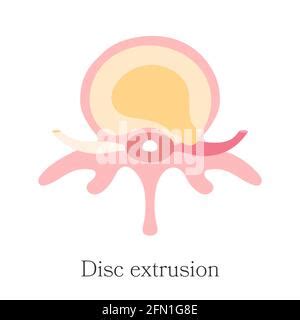 Image result for Exploding Retail Sticker