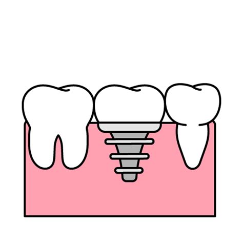 Image result for Tooth Mobility Classification Chart