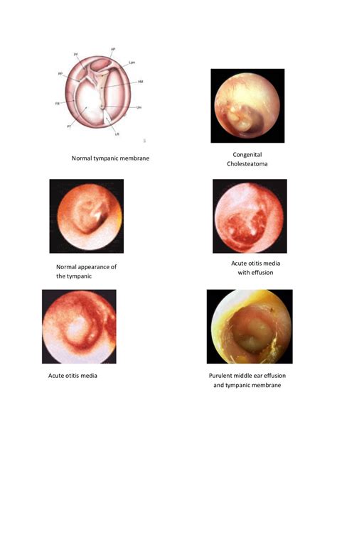 Tympanic membrane dr. fadil