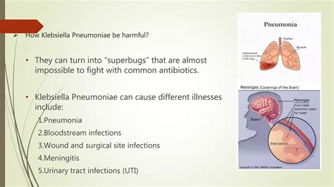 Klebsiella Pneumoniae CH.U | PPTX