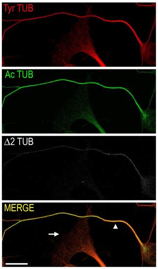 Ubiquitin Proteasome System and Microtubules Are Master Regulators of ...