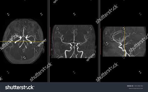High Res Brain Scan Image 的图像结果
