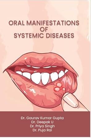 Buy ORAL MANIFESTATIONS OF SYSTEMIC DISEASES Book Online at Low Prices ...