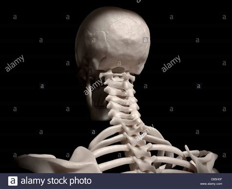 Is it normal to have a dent in the upper back portion of your skull ...
