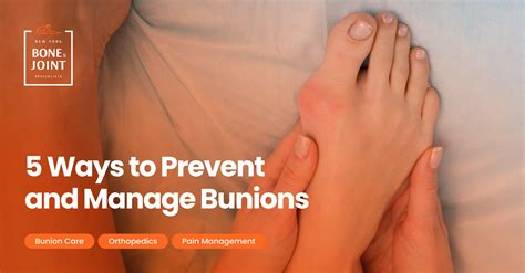 ByeBye Bunions: Your Friendly Guide to Prevention