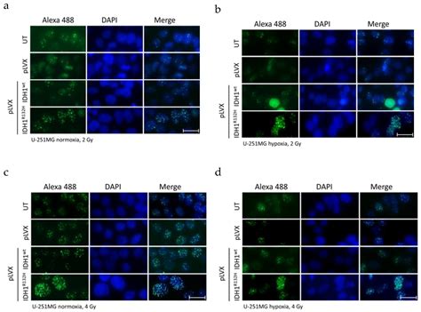 Radiosensitization and a Less Aggressive Phenotype of Human Malignant ...