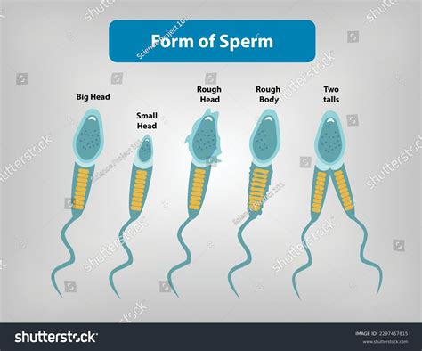 Form Morphology Sperm Stock Vector (Royalty Free) 2297457815 | Shutterstock