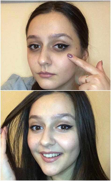 Can Vaseline Help Get Rid Of Under Eye Bags at Kelley Bishop blog