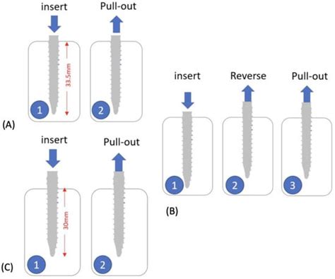 Pullout Strength of Pedicle Screws Inserted Using Three Different ...