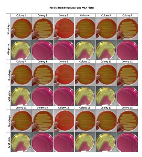 Results from Blood Agar and MSA Plates Results | Chegg.com