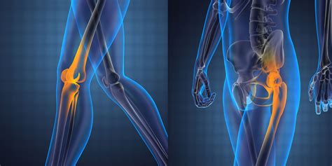Knee And Hip Replacement - Orthopedic Surgeon Monmouth County NJ | Marshall P. Allegra, M.D.