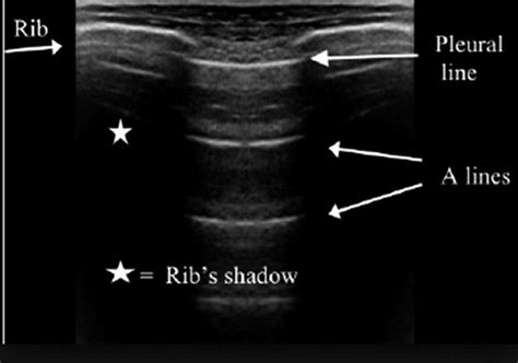 Image result for Bat Sign Thin Line