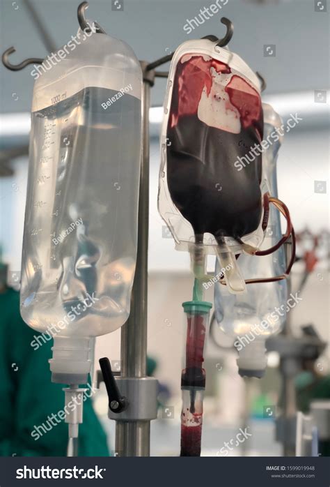 Difference Between Iv Set And Blood Set at Tasha Hyman blog