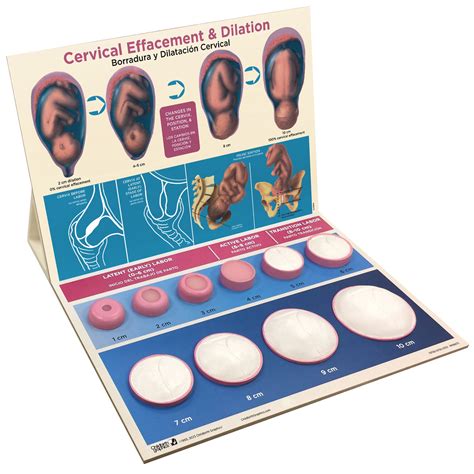 Cervical Dilation Easel Display | Childbirth Graphics
