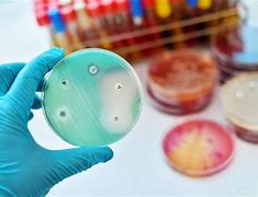 Antibiotic discovered with AI 的图像结果