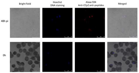 Initiated Babesia ovata Sexual Stages under In Vitro Conditions Were ...