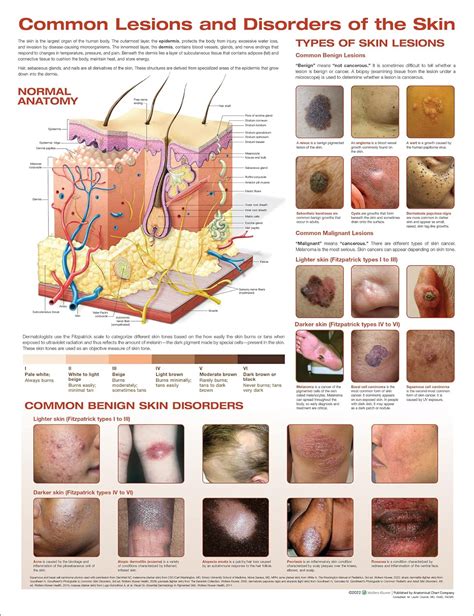Common Lesions and Disorders of the Skin Anatomical Chart: Anatomical Chart Company ...