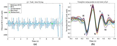 Signal Quality Index Based on Template Cross-Correlation in Multimodal ...