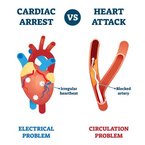 Understanding Sudden Cardiac Arrest And How Basic Life Support Can Help ...
