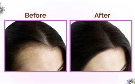 Buy Mamaearth Rosemary Hair Growth Oil with Rosemary & Methi Dana for ...