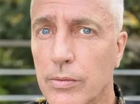 Marley sufrió un “accidente” y mostró cómo le quedó: “¿Quién podrá ...