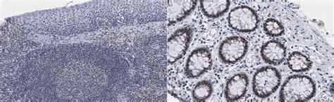 Anti-PRDM1 (BLIMP-1) Antibody, clone ROS195G | MABE1814-100UG