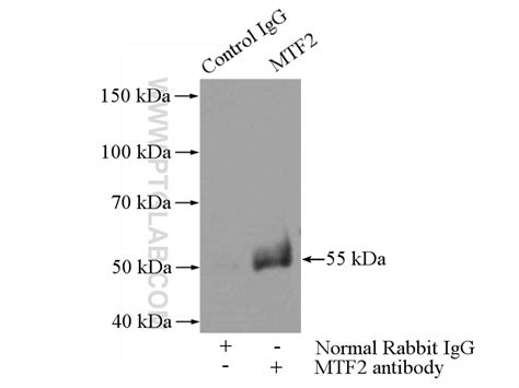 MTF2 antibody (16208-1-AP) | Proteintech